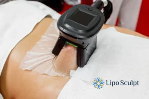 Cryolipolysis Helping You Getting that Perfect Summer Body 3 Cryolipolysis Bradford can give you the best summer body - contact us today!