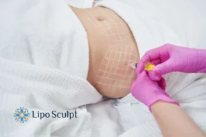 Are The Results From Aqualyx Permanent? 1 Do you want to know how long Aqualyx Bradford results last?