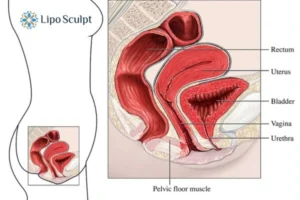 Treatment For A Leaky Bladder 2 How EM Chair treatment Bradford can help Leaky bladder issues. Read more now!