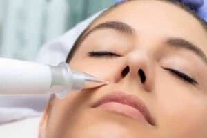 Best Actinic Keratoses Removal 3 Actinic keratoses Bradford solutions - book in today!